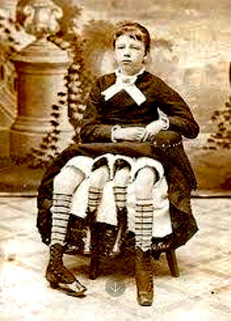 Myrtle corbin as a young girl. Jawa Update: Inilah Foto Manusia Terunik di Dunia. Ada Yang Berkaki 4 dan lain lain