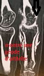 The company sells natural health and wellness products, including health foods, dietary supplements such as vitamins, minerals, herbs. prothese ou arthrodese de doigt pathologies et operations ...
