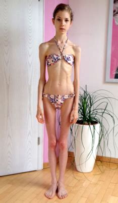 Brazilian, dominican, black, latin, asian, fat, skinny, old and ugly. Girl battling anorexia who lived off 39 calories a day and ...