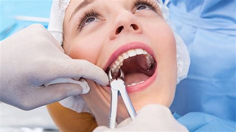 How long does the tooth extraction process take? When Can You Use Straws Wisdom Teeth - TeethWalls