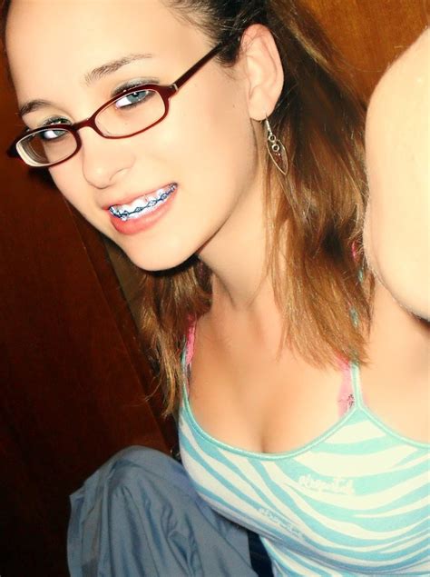 See more of girls with braces are hot on facebook. Braces by Miss-Chievous-Love on DeviantArt