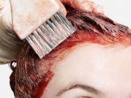 Most allergy cause skin rashes, not scalp rashes (unless they're really severe). Hair dye allergy reactions: Symptoms and treatments