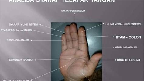 Namun, bisa jadi ini menandakan adanya kondisi medis yang mendasari. Deteksi Penyakit Anda Melalui Telapak Tangan - Serambi ...