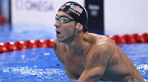 Cupping is also combined into remedial or sports massage for better results. What is cupping? Controversial therapy dominating Rio ...