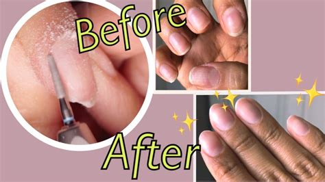 We did not find results for: Exfoliating my super dry cuticles - Russian Manicure - YouTube