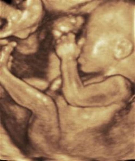 Ein geburtsvorbereitungskurs wäre sehr überhaupt finde ich es sehr schön, wenn papa und du eure hände auf „unseren bauch legt. Zwillinge in der 22. Woche (SSW 21) - babywelten.ch