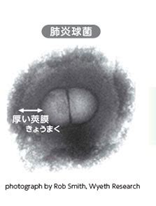 4:30 肝病防治學術基金會 3 811 просмотров. 2種類ある肺炎球菌ワクチン〜ニューモバックスとプレベナー ...