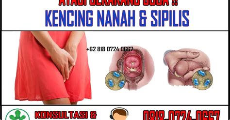 Aktif bisa dengan melakukan olahraga ringan seperti senam atau berjemur di pagi hari. 4 Alasan Kenapa Ada Rasa Gatal Serta Bintik Bintik Merah ...