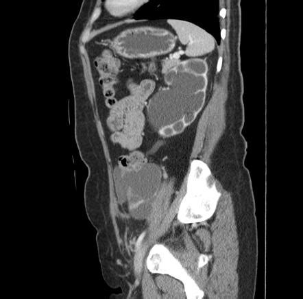 O in addition, by the end of the 2nd year of fellowship, one should be able to 3. Image | Radiopaedia.org