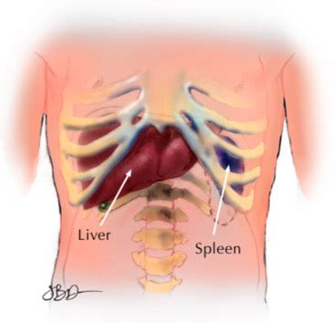 Pain coming from a person's rib cage may be nothing serious, or it may the pain associated with the rib cage may be sudden and sharp or dull and aching. What is the Spleen? | CLL Society