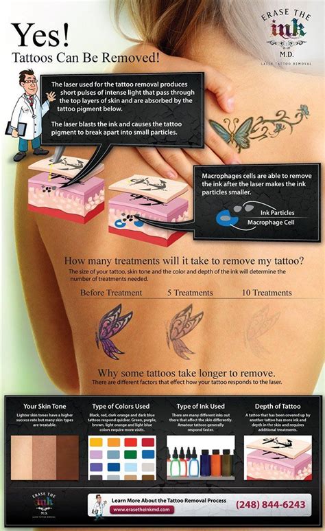 Allergic reaction to an ink. 20 Essential Things That You Need To Know Before Getting ...