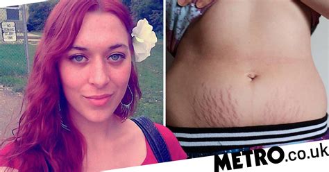 This is the most basic concern what many individuals face. Mum says breast milk helped fade her stretch marks | Metro ...