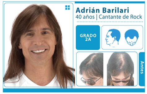 Adrián barilari's profile including the latest music, albums, songs, music videos and more updates. CHimentoS ChakY!!