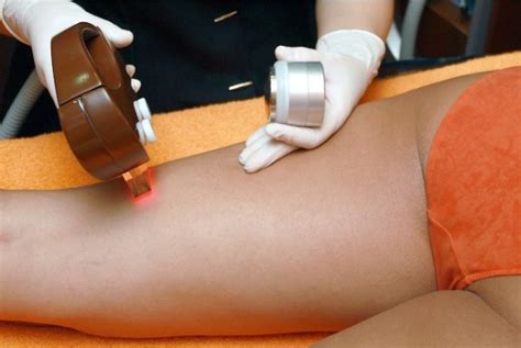 If you had laser hair removal treatments in other areas, you can expect the same sensation in the pubic region as well. What Can You Expect During Brazilian Laser Hair Removal ...