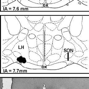 We would like to show you a description here but the site won't allow us. Proteine Atlas Rat : Proteine Atlas Rat A Human Liver Cell Atlas Revealing Cell Type ...