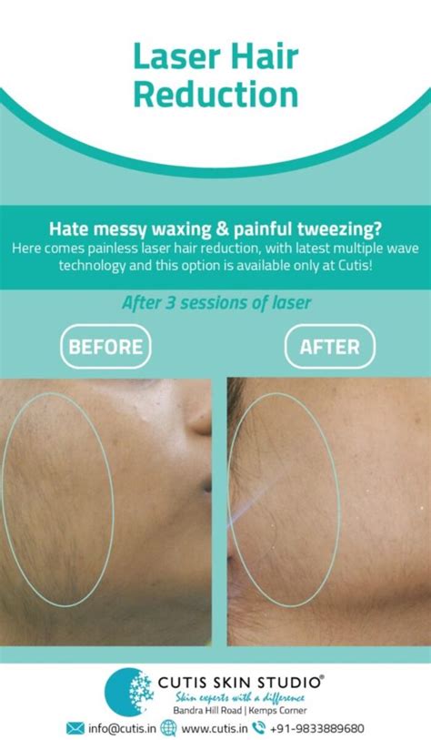 The cost depends on the amount of hair on the body and how many treatment sessions are needed. Full Body Laser Hair Removal Cost in Mumbai | A Listly List