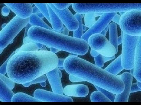 La légionellose est une infection respiratoire causée par la bactérie legionella. La légionellose : présentation et prévention