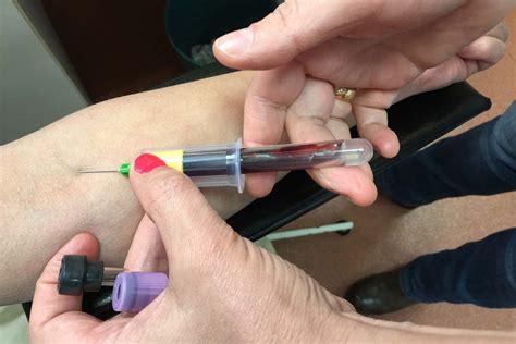 Prior reservation is required and subject to availability of appointment. Blood test detects Alzheimer's plaques building up in ...