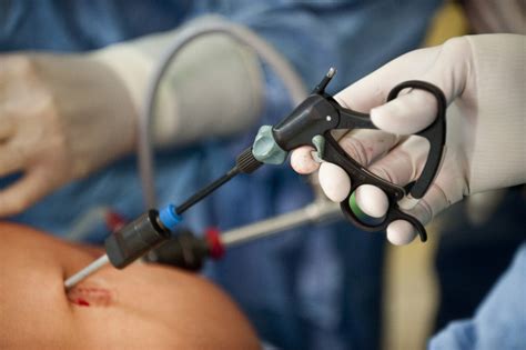 Der blinddarm (lateinisch caecum, coecum oder cecum bzw. Klinik für Allgemein- und Viszeralchirurgie Bruchsal