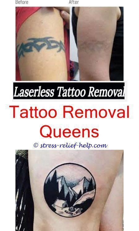 Still, the question you must ask yourself is: Can you do laser tattoo removal when pregnant.Should i get ...