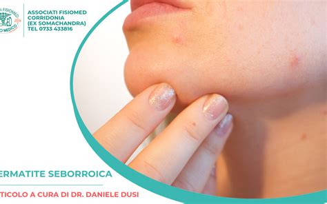Dermatite Seborroica:Mini Guida,consigli dell'esperto ...