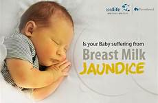 jaundice breast milk suffering baby