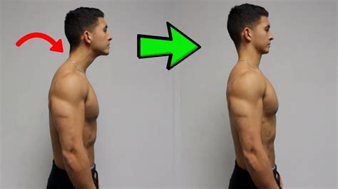 Good as i want to because of this posture. Finding a Permanent Shoulder Fix for a Better Life ...