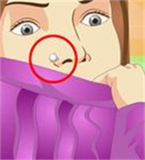 Nose rings or stud backs can loosen or shift in your hole. 3 Ways to Treat an Infected Nose Piercing - wikiHow