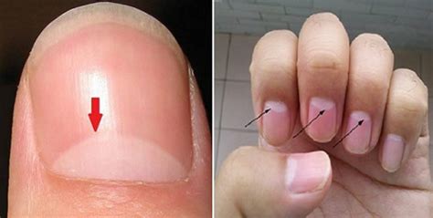 This native is very perceptive, and will naturally know what needs to be done to strengthen the bonds in their love life. If You Have The Half Moon Shape On Your Nails, This Is ...