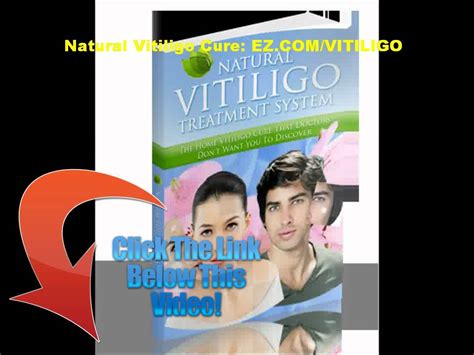 There are no proven home remedies to cure vitiligo, but the use vitiligo: VITILIGO CURE - YouTube