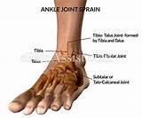 The answer may be in another study showing that lateral ankle ligament surgery and repair actually lead to abnormal motion of the foot and ankle. Ankle Joint Sprain|Causes|Types|Symptoms|Treatment-Conservative, Specific, PT
