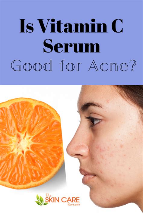 Benefits of using a hair serum. Is Vitamin C Serum Good For Acne Prone Skin? | Best ...