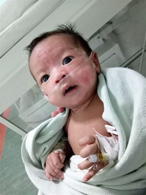 Jangan menganggapnya sebagai kondisi ringan layaknya batuk yang bisa sembuh dengan sendirinya. Akibat Orang Tak Sihat Cium Baby, Si Kecil Kena Jangkitan ...