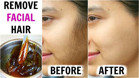 Try the body and facial hair remedies and removal tips that can be done at home using simple natural ingredients. How To Remove Facial Hair (Demonstration) KATORI WAX - In ...