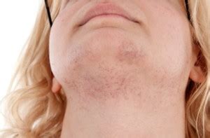 There are many ways to remove unwanted hair in the face and neck. What's Causing Your Female Facial Hair? - Health Tips ...