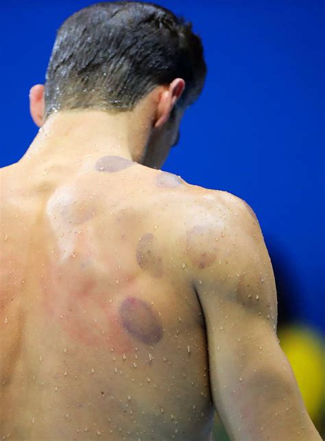 It means that when a russian olympian wins gold, the russian flag won't be flown, and the russian why is russia banned from the olympics? Rio Olympics 2016: What is Cupping Therapy and why is ...