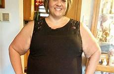 mother obese sugar removal launched excess fundraising pay campaign try skin she help her