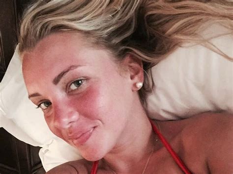 Evelyn burdecki kassiert korb vom bachelor. Krasse Verbrennungen: Bachelor-Evelyn fast verbrutzelt ...