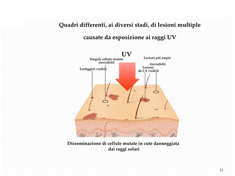 La piel es el órgano de mayor extensión del cuerpo, su gran superficie oscila entre 1,6 y 2 metros cuadrados en el adulto. La Cheratosi Attinica - Giulio Sonego - Dermatologo