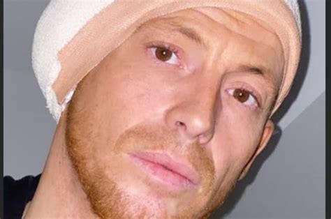 Joe swash has his ear injury drained for the second time in hospital as he suffers setback. Joe Swash opens up about horror ear injury during Dancing ...