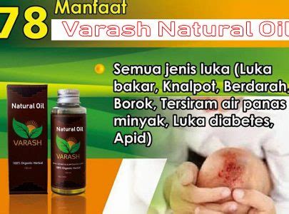 Check spelling or type a new query. 78 Manfaat Minyak Varash Natural Oil - Varash (+6285730610052)