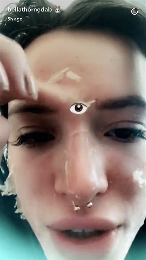 Microneedling has been proven to be an effective treatment for everything from wrinkles, hyperpigmentation, and dull skin microneedling, also called collagen induction therapy (cit), is a. Shedding Microneedling / Shedding Light on PRP ...
