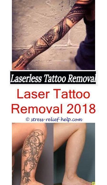 I was quoted 16 sessions for total removal, at $400 per session—anything over 14 sessions would be free—but my body is responding incredibly well to the process. getting a tattoo removed how to remove tattoo at home ...