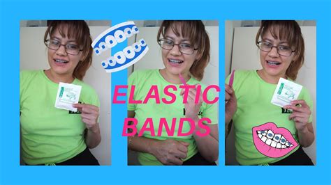 Find out which household objects you can revamp. How to put on elastic bands for braces || Braces Update ...