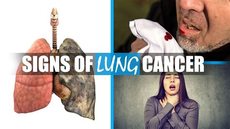 There is a possibility that cancer has spread to the brain. Symptoms of lung cancer - What are early signs of lung ...