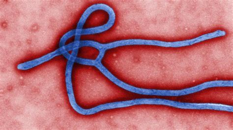 Ebola virus and marburg virus: Ebola-Virus: Ebola: Symptome, Übertragung - alle Fragen ...