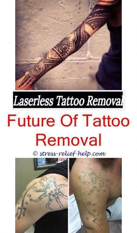 Pricing of a tattoo can get really complicated really fast. How much for tattoo removal cost.How much does getting a tattoo removed cost.Inked up tattoo ...