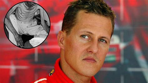 .посмотрите в instagram фото и видео michael schumacher (@michaelschumacher). Smutná zpráva: Michael Schumacher váží jen 45 kilogramů ...