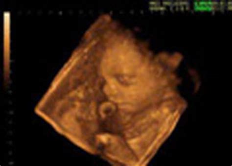 The tiny baby was diagnosed with cancer when she was just days old after developing it in the wombcredit: Wisconsin Planned Parenthood Will Sue to Stop Women From ...