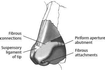 It is a thickening of tenon's capsule, the dense connective tissue capsule surrounding the globe and separating it from orbital fat. 45. Rhinoplasty | Plastic Surgery Key